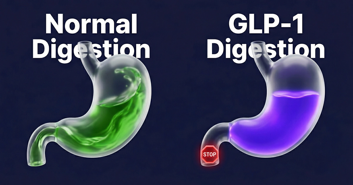 Comparison of normal gastric emptying vs delayed emptying, a primary driver of GLP-1 side effects.