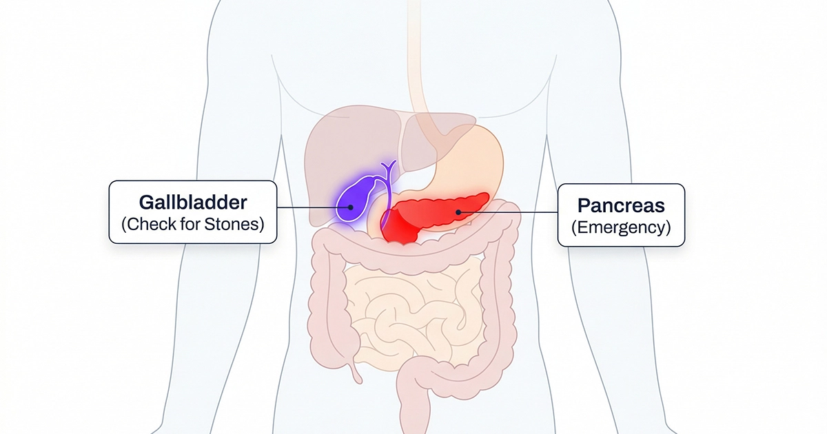 Pain map distinguishing Gallbladder and Pancreas pain zones regarding serious GLP-1 side effects.